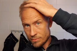 fungerande metoder mot håravfall