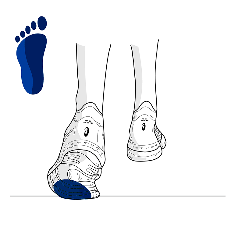 What is pronation